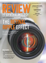 Review of Ophthalmology