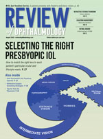 Review of Ophthalmology