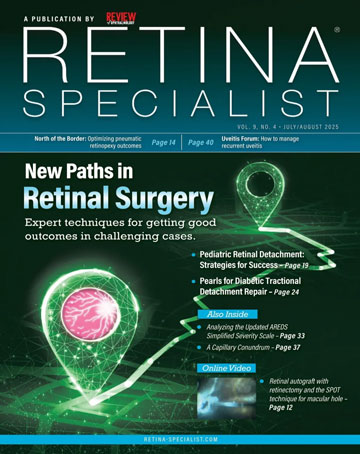 Retina Specialist