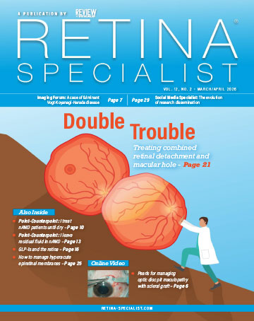 Retina Specialist