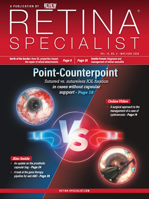 Retina Specialist