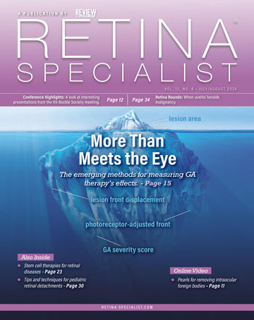 Retina Specialist