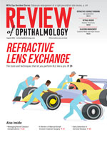 Review of Ophthalmology