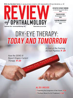Review of Ophthalmology